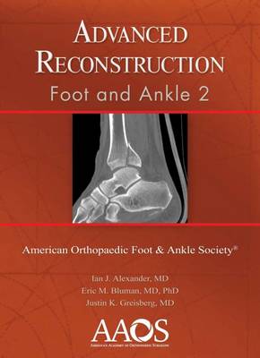 Advanced Reconstruction: Foot and Ankle 2