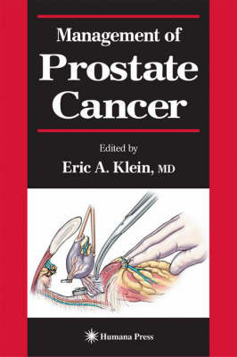 Management of Prostate Cancer