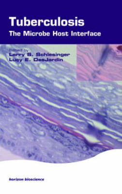 Tuberculosis