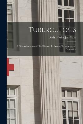 Tuberculosis