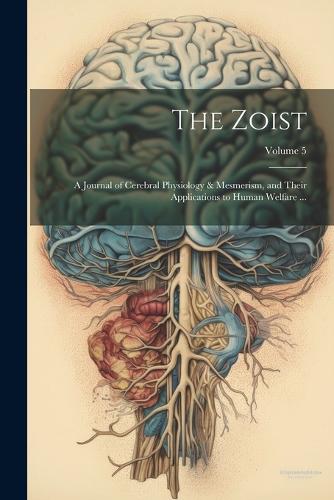 The Zoist