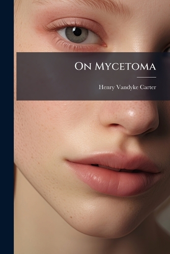 On Mycetoma