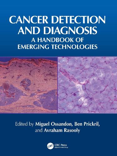 Cancer Detection and Diagnosis