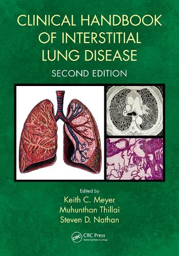 Clinical Handbook of Interstitial Lung Disease