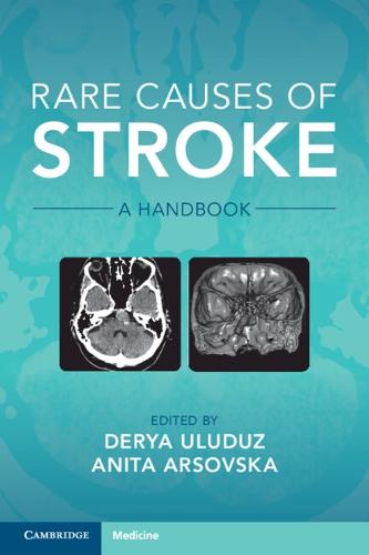 Rare Causes of Stroke