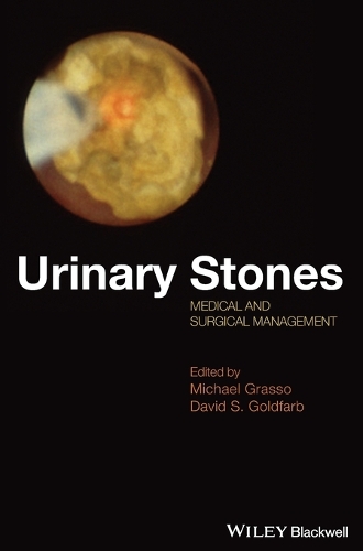 Urinary Stones