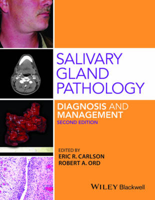 Salivary Gland Pathology