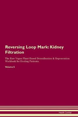 Reversing Loop Mark