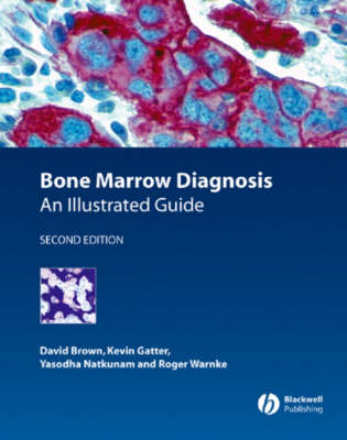 Bone Marrow Diagnosis