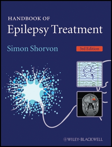Handbook of Epilepsy Treatment