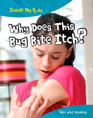 Why does this Bite Itch?