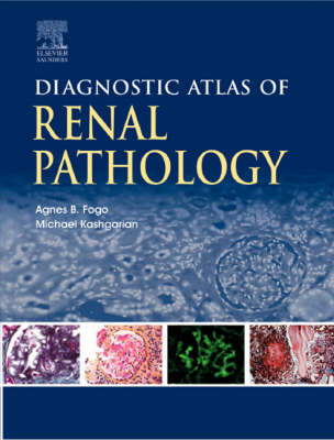 Diagnostic Atlas of Renal Pathology