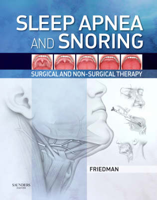 Sleep Apnea and Snoring