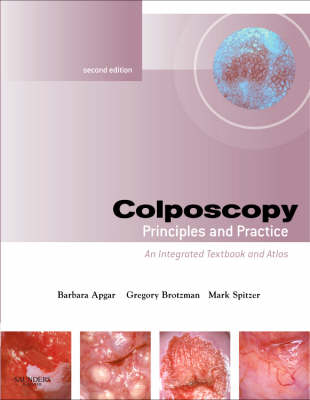 Colposcopy