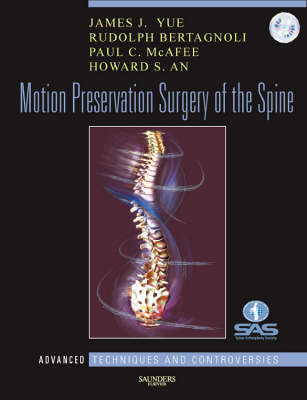 Motion Preservation Surgery of the Spine
