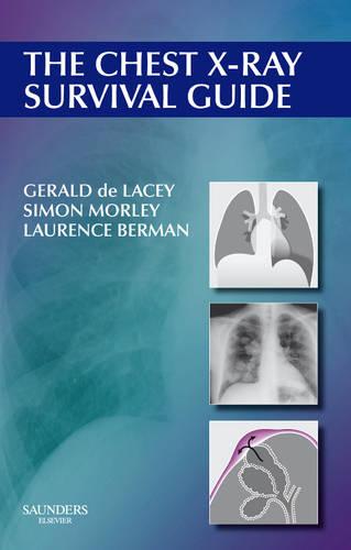 The Chest X-ray Survival Guide
