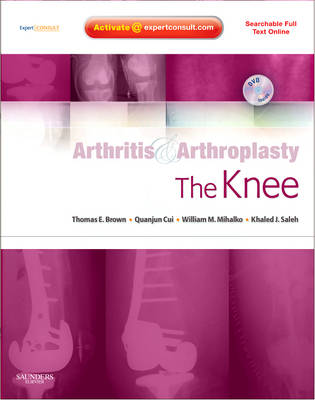 Arthritis and Arthroplasty: The Knee