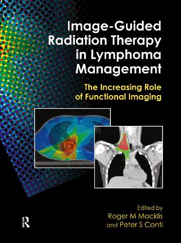Image-Guided Radiation Therapy in Lymphoma Management