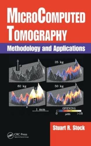 MicroComputed Tomography