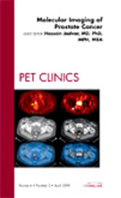 Molecular Imaging of Prostate Cancer, An Issue of PET Clinics Volume 4-2