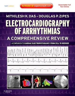 Electrocardiography of Arrhythmias: A Comprehensive Review