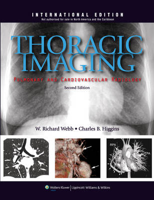 Thoracic Imaging