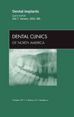 Dental Implants, An Issue of Dental Clinics Volume 55-4