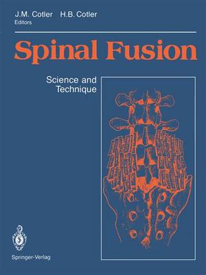 Spinal Fusion