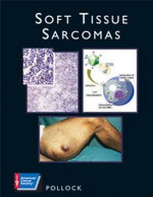 Soft Tissue Sarcomas