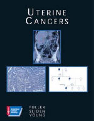 Uterine Cancer
