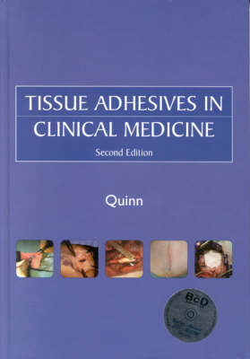 Tissue Adhesives in Clinical Medicine