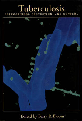 Tuberculosis