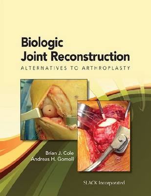 Biologic Joint Reconstruction