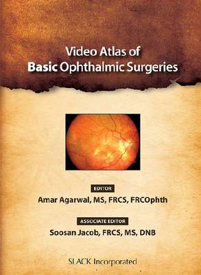 Video Atlas of Basic Ophthalmic Surgeries