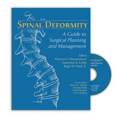 Spinal Deformity