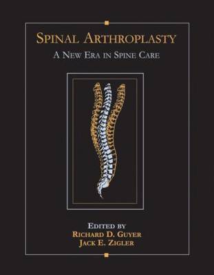 Spinal Arthroplasty