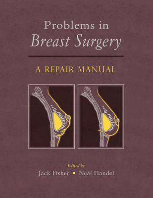 Problems in Breast Surgery
