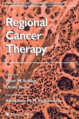 Regional Cancer Therapy