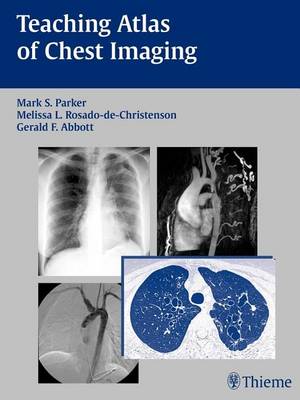 Teaching Atlas of Chest Imaging