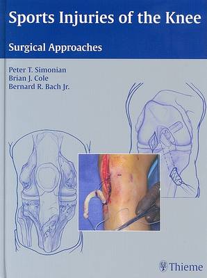 Sports Injuries of the Knee