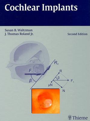 Cochlear Implants