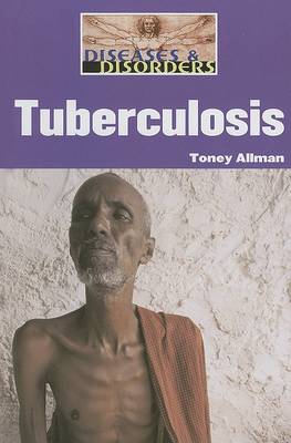 Tuberculosis