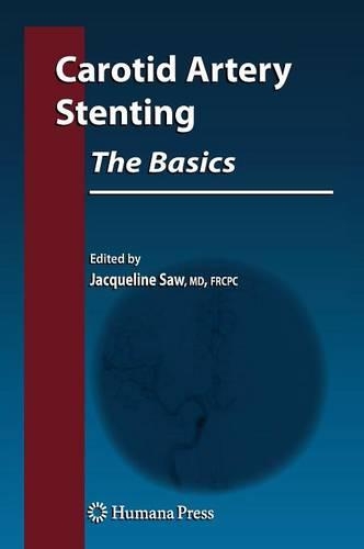 Carotid Artery Stenting: The Basics