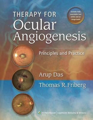 Therapy for Ocular Angiogenesis: Principles and Practice
