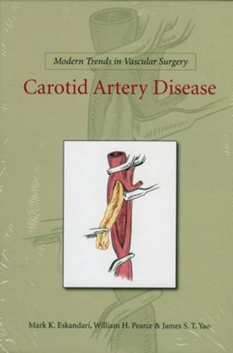 Modern Trends in Vascular Surgery: Carotid Artery Disease