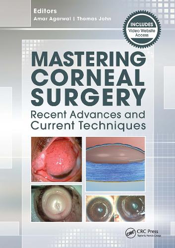 Mastering Corneal Surgery