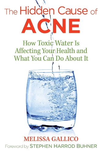 The Hidden Cause of Acne