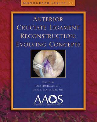 Anterior Cruciate Ligament Reconstruction