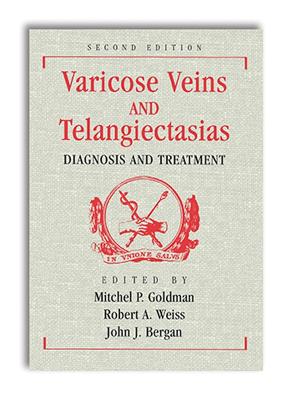 Varicose Veins and Telangiectasias: Diagnosis and Treatment, Second Edition