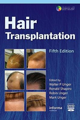 Hair Transplantation